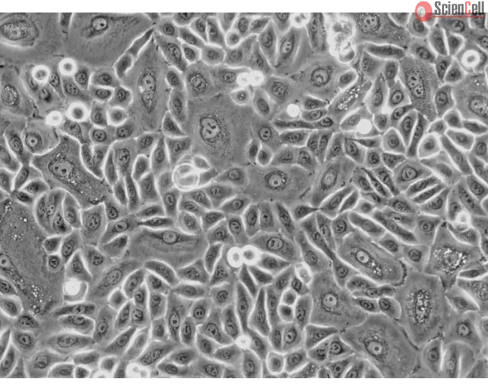 Human Tonsil Epithelial Cells (HTEpiC) - Phase contrast, 200x.
