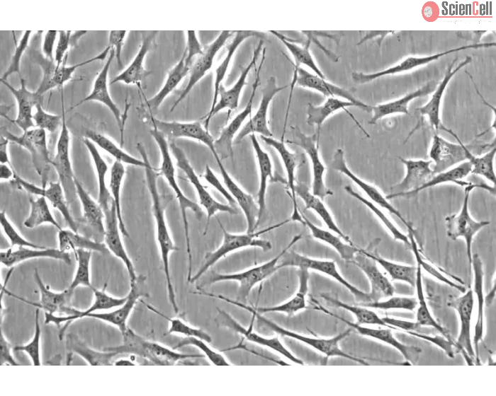 Human Trabecular Meshwork Cells (HTMC) - Phase contrast, 200x.
