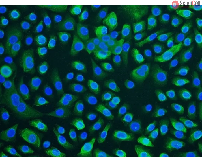 Human Tracheal Epithelial Cells (HTEpiC) - Immunostaining for CK-18, 100x.
