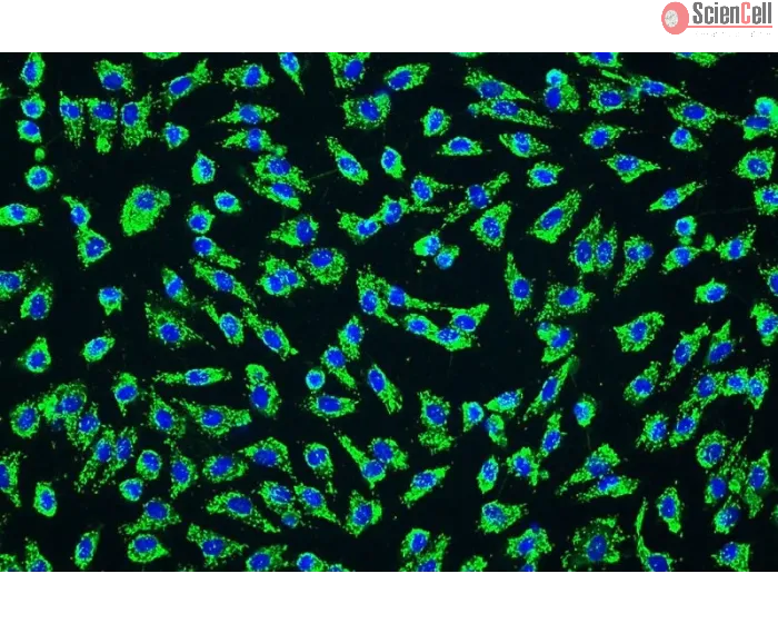 Human Umbilical Artery Endothelial Cells (HUAEC) - Immunostaining for vWF, 200x.
