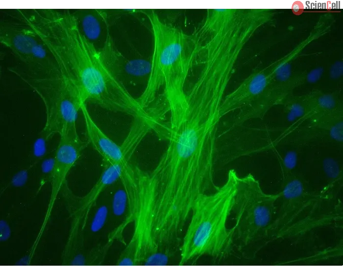 Human Umbilical Vein Smooth Muscle Cells (HUVSMC) - Immunostaining for α-SMA, 400x.
