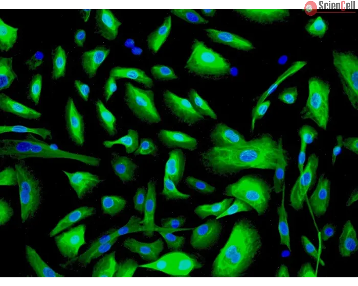 Human Urothelial Cells (HUC) - Immunostaining for CK-19, 200x.
