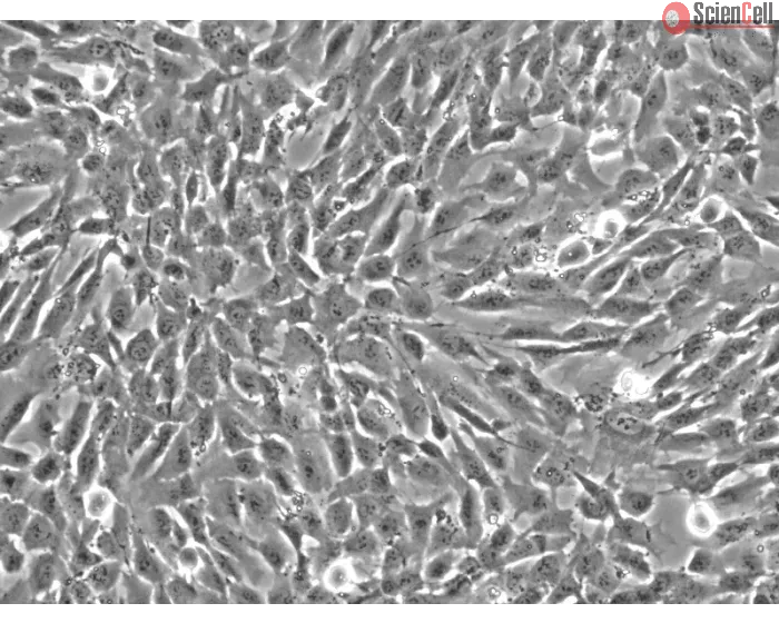 Human Vertebral Mesenchymal Stem Cells (HVMSC) - Phase contrast, 200x.
