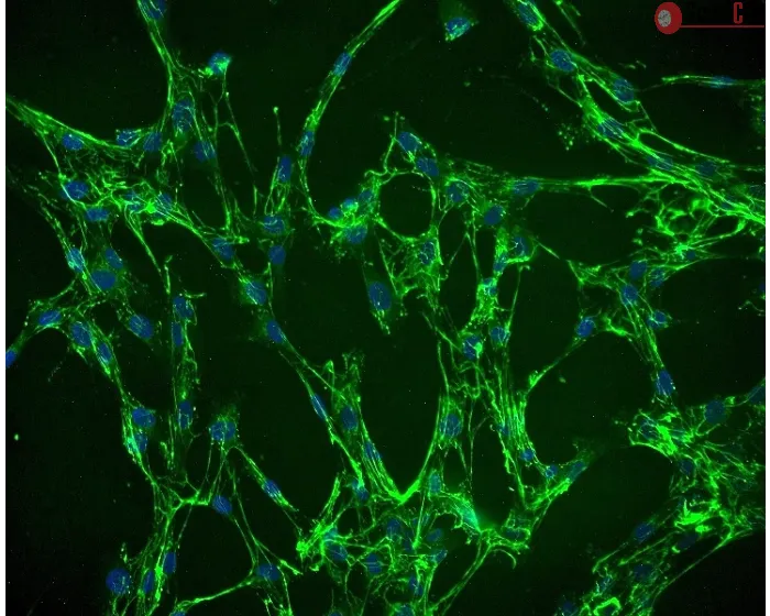 Human Villous Mesenchymal Fibroblasts (HVMF) - Immunostaining for Fibronectin, 200x.
