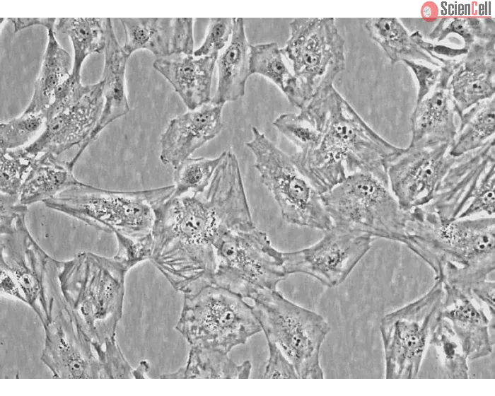 Human Villous Trophoblasts (HVT) - Phase Contrast, 400x
