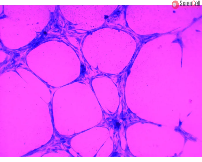 In Vitro Tube Formation Assay