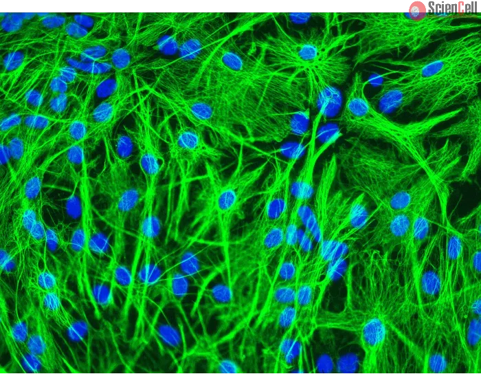 Mouse Astrocytes (MA) - Immunostaining for GFAP, 200x.
