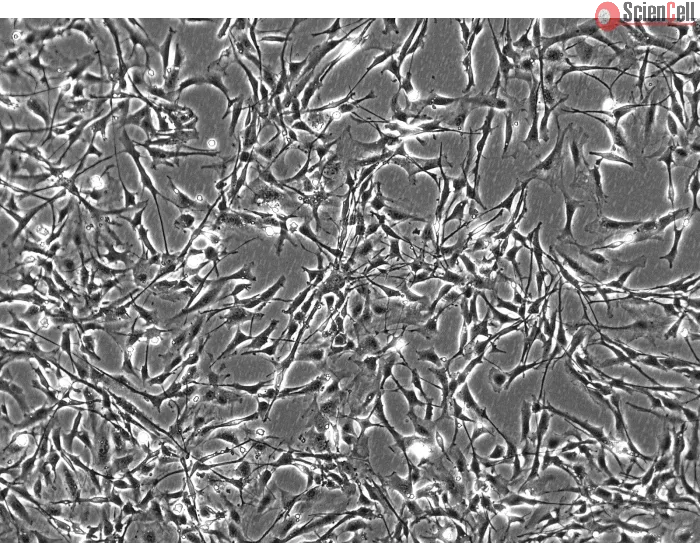 Mouse Astrocytes (MA) - Phase contrast, 100x.
