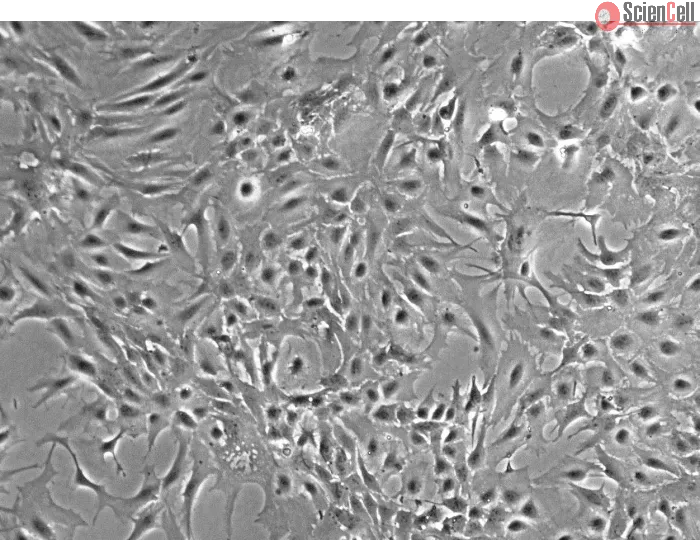 Mouse Astrocytes-hippocampal (MA-h) - Phase contrast, 100x.
