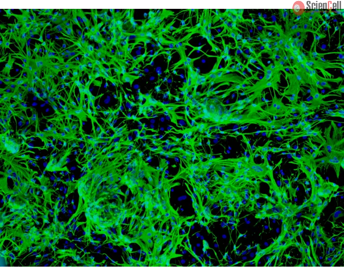 Mouse Astrocytes-midbrain (MA-mb) - Immunostaining for GFAP, 100x.
