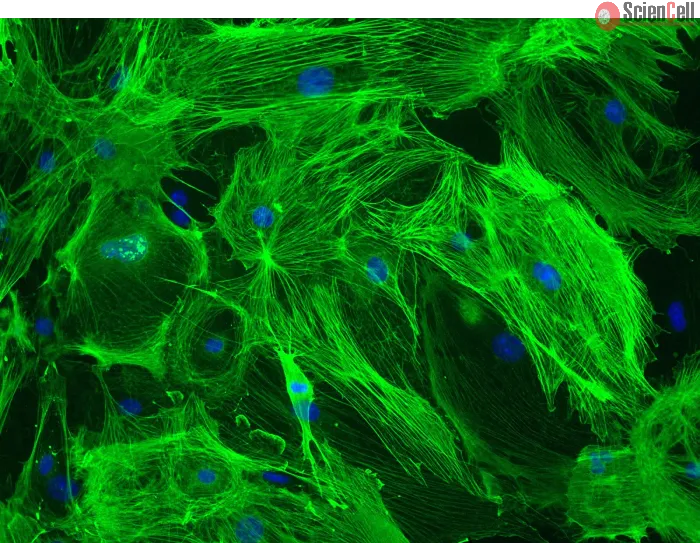 Mouse Brain Vascular Pericytes (MBVP)-Immunostaining for α-SMA, 200x
