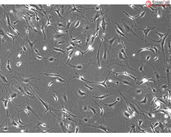 Mouse Dermal Fibroblasts (MDF)- Phase Contrast, 100x