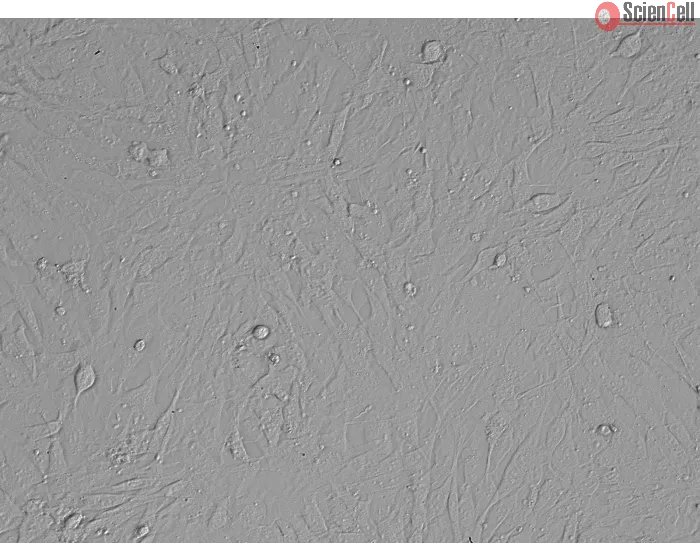 Mouse Embryonic Fibroblasts (MEF) - Relief Contrast, 200X.
