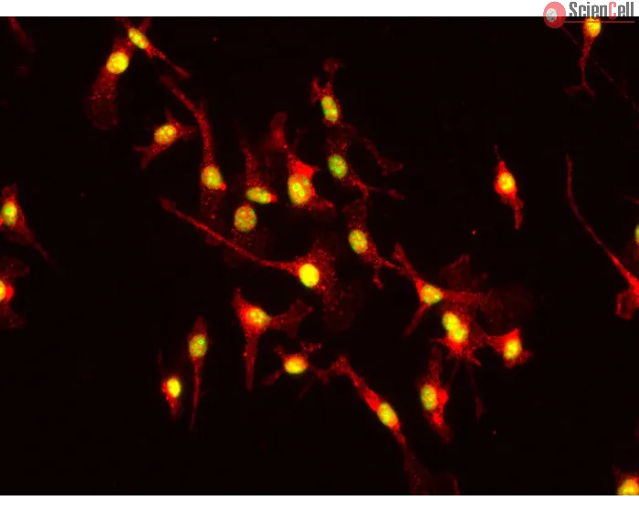 Mouse Hepatic Macrophages (MHMa)-Immunostaining for F4/80, 400x
