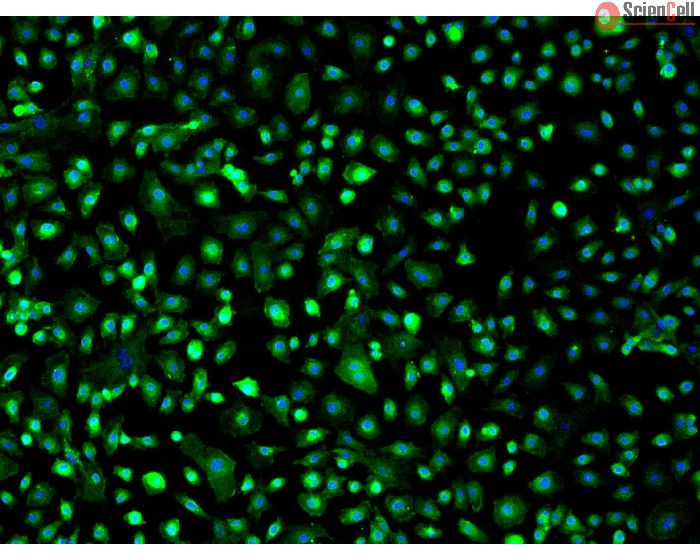 Mouse Hepatic Mesothelial Cells (MHMeC) - Immunostaining for Mesothelin, 200x