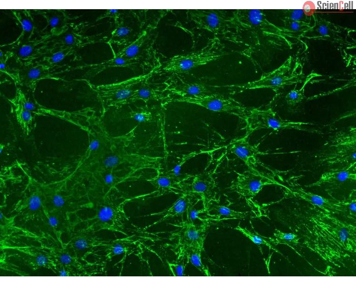 Mouse Lymphatic Fibroblasts (MLF) – Immunostaining for Fibronectin, 200x
