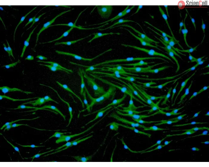 Mouse Macrophages-bone marrow (MMa-bm) - Immunostaining for CD11b, 200x.
