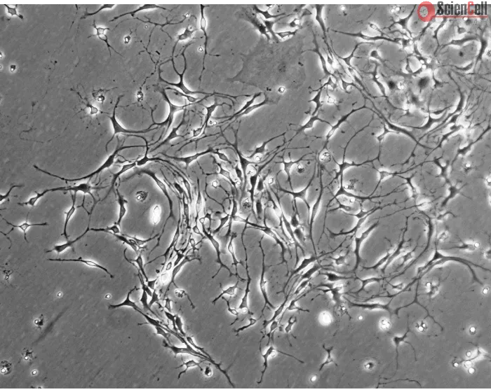 Mouse Neurons-striatal (MN-s) - Phase contrast, 100x.
