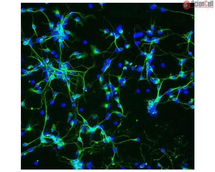 Mouse Neurons-substania nigra (MN-sn) - Immunostaining for β-Tubulin III, 200x.
