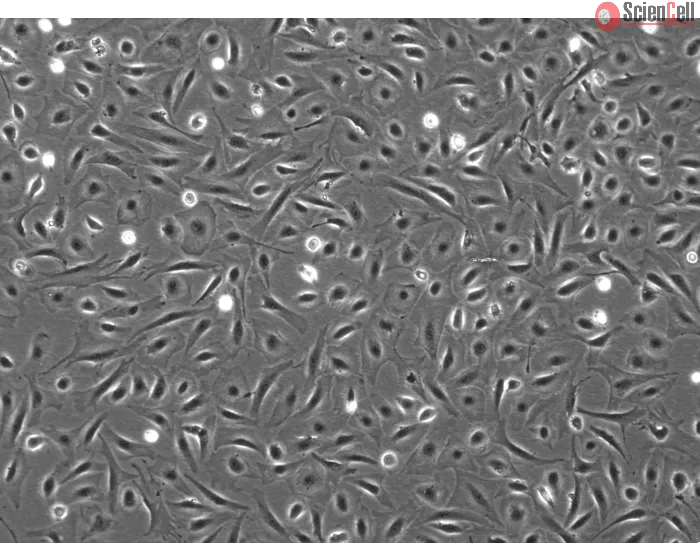 Mouse Pulmonary Alveolar Epithelial Cells (MPAEpiC) - Phase contrast, 100x
