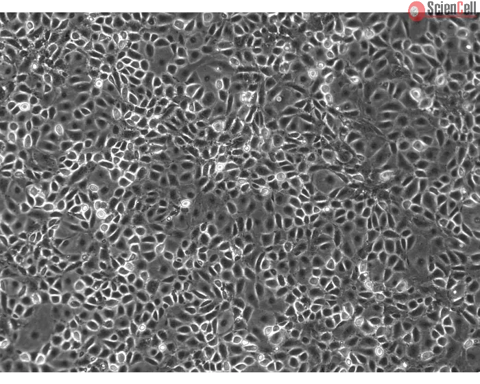 Mouse Pulmonary Alveolar Epithelial Cells (MPAEpiC) - Phase contrast, 100x
