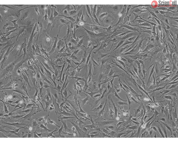 Mouse Pulmonary Fibroblasts (MPF) - Phase contrast, 100x.
