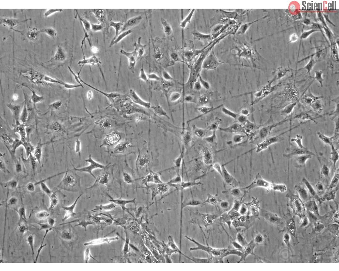 Mouse Renal Mesangial Cells (MRMC) - Phase contrast, 100x.
