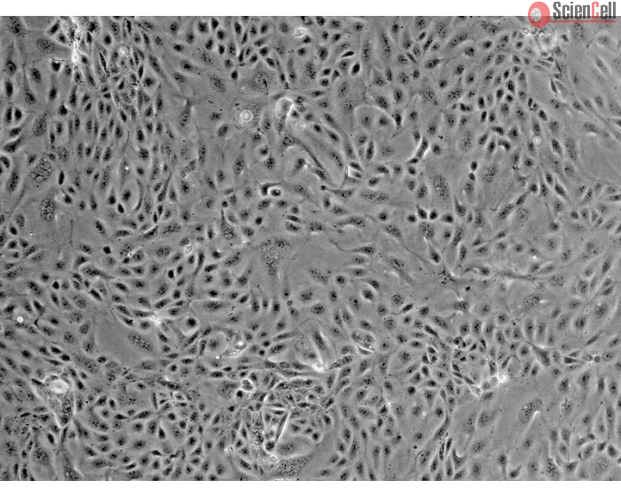 Mouse Renal Proximal Tubular Epithelial Cells (MRPTEpiC) - Phase contrast, 100x.
