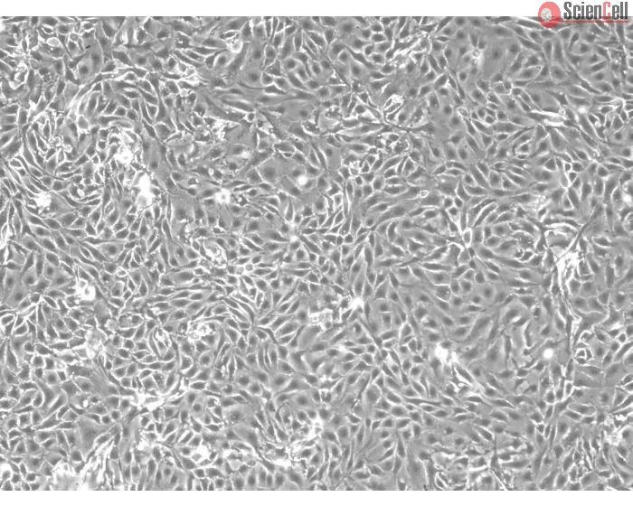 Mouse Renal Proximal Tubular Epithelial Cells (MRPTEpiC) - Phase contrast, 100x.
