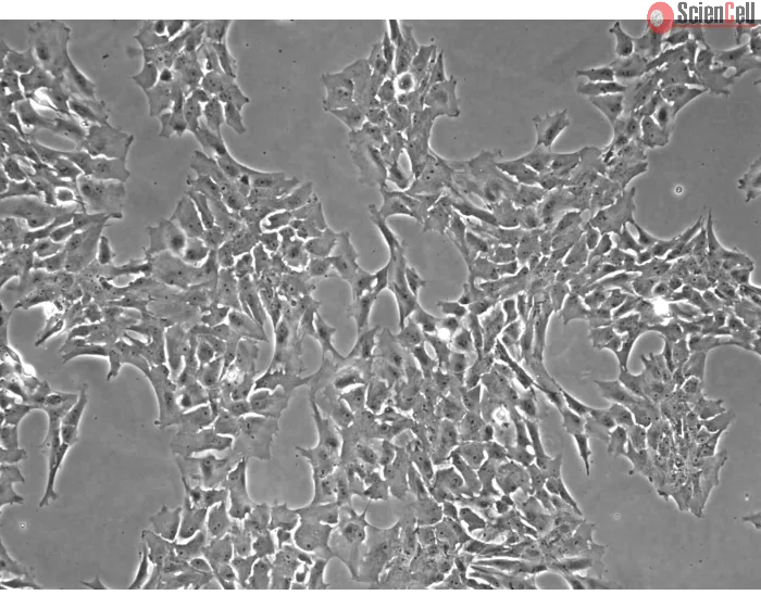 Porcine Retinal Astrocytes (PA-r)- Phase Contrast, 100x.
