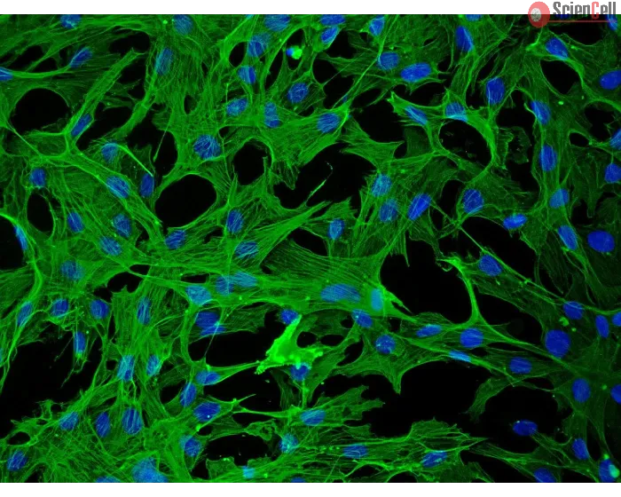 Rabbit Hepatic Stellate Cells (RabHSteC) – Immunostaining for alpha-smooth muscle actin, 200x.
