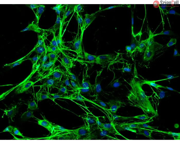 Rabbit Pulmonary Fibroblasts (RabPF) – Immunostaining for FN, 200x.
