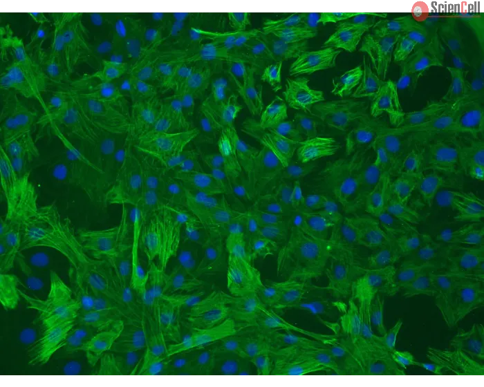 Rat Aortic Smooth Muscle Cells (RASMC) – Immunostaining for α-sma, 200x
