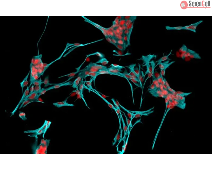 Rat Astrocytes-cerebellar (RA-h) - Immunostaining for GFAP, 200x.
