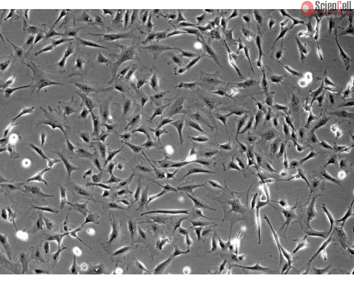 Rat Cardiac Fibroblasts (RCF) - Phase contrast, 100x.