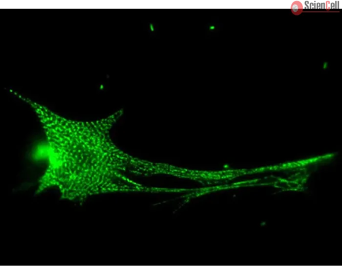 Rat Cardiac Myocytes (RCM) – Immunostaining for Sarcomeric alpha-Actinin (Boster, Cat #MA1104)
