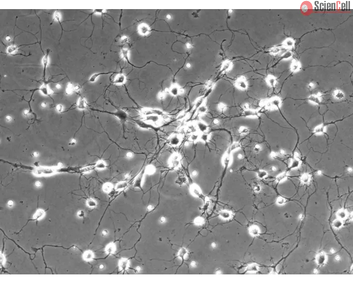 Rat Cerebellar Granule Cells (RGC) - Phase contrast, 200x.
