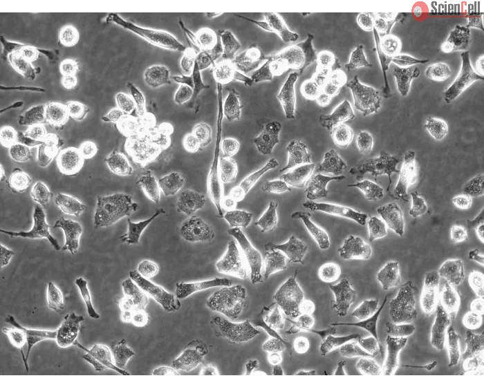 Rat Hepatic Macrophage (RHMa) - Phase contrast, 200x.
