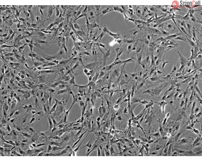 Rat Meningeal Cells (RMC) - Phase contrast, 100x.
