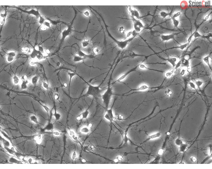 Rat Neurons-striatal (RN-s) - Phase contrast, 200x.
