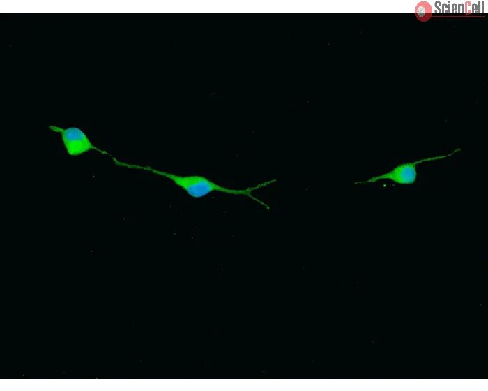 Rat Oligodendrocyte Precursor Cells (ROPC) – Immunostaining for O1, 400x.
