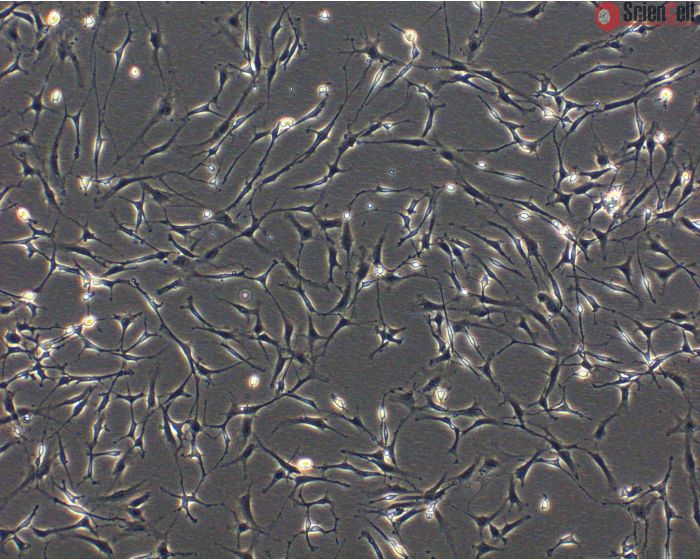 Rat Perineurial Fibroblasts (RPNF)- Phase Contrast, 100X.