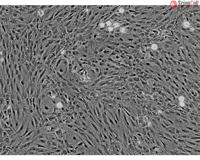 Rat Perineurial Fibroblasts (RPNF) - Phase contrast, 100x.
