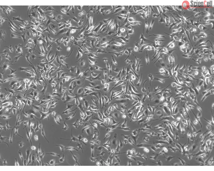 Rat Pulmonary Alveolar Macrophages (RPAMa) - Phase contrast, 100x
