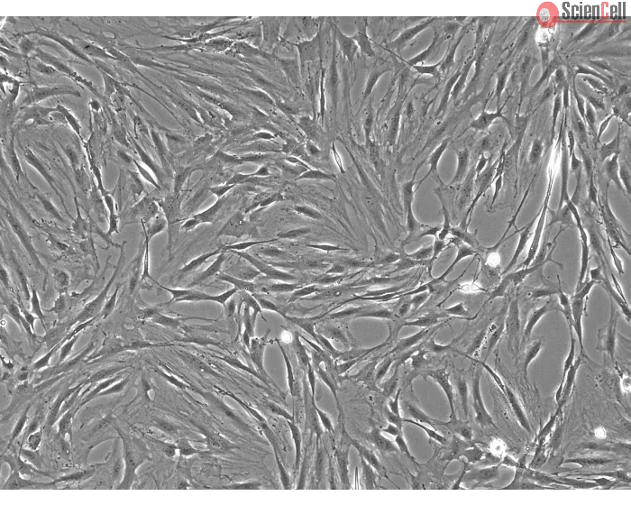 Rat Pulmonary Artery Smooth Muscle Cells (RPASMC)- Phase Contrast, 100x