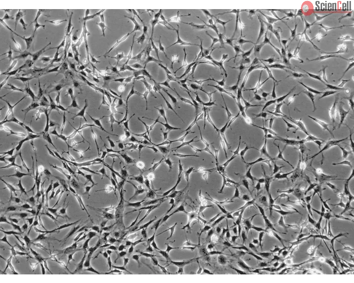 Rat Salivary Gland Fibroblasts (RSGF) - Phase contrast, 100x.
