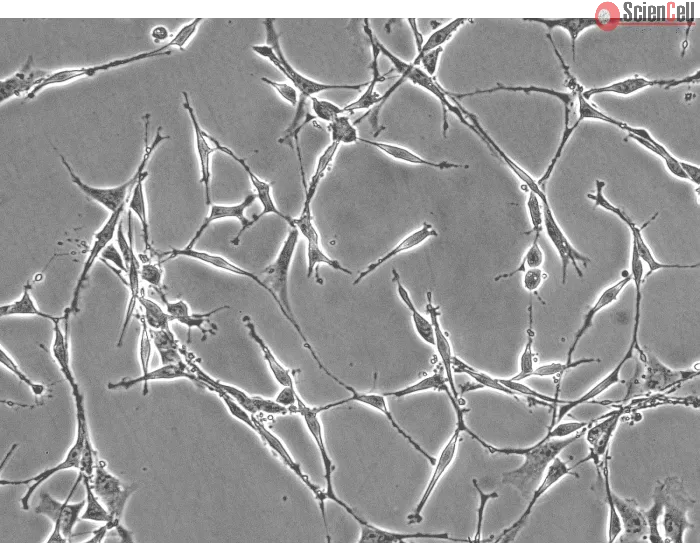 Rat Schwann Cells (RSC) - Phase contrast, 200x.
