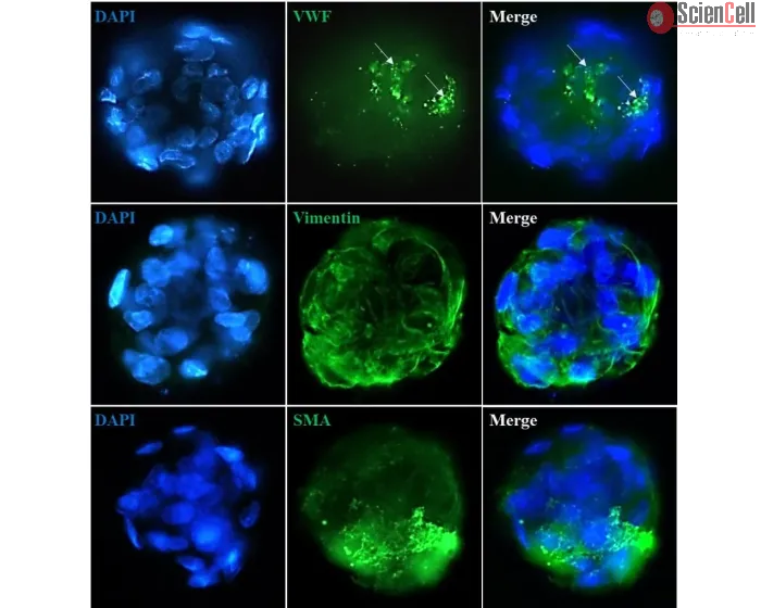 Immunostaining of the hepatic stellate cell-sinusoidal endothelial cell co-culture spheroids with the stellate cell markers (Vimentin and Smooth Muscle Actin) and the endothelial cell marker Von Willebrand Factor . 