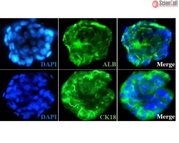 Day 7; Immunostaining of the hepatocyte-stellate cell co-culture spheroids with the hepatocyte markers such as albumin (ALB) and cytokeratin18 (CK18)
