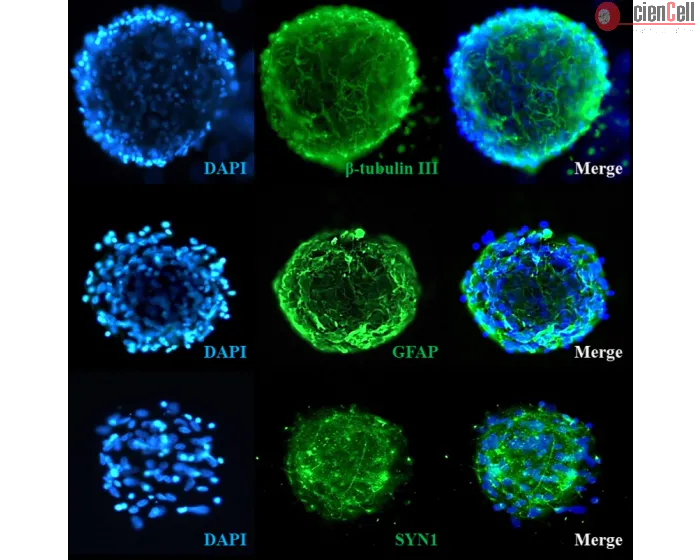 Human Cortical Spheroids at Day 7